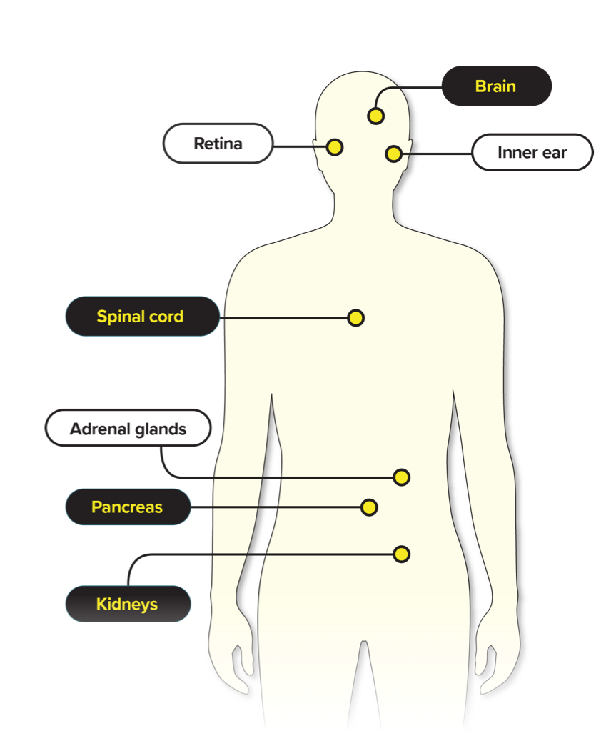 Possible Sites of von Hippel-Lindau (VHL) Disease–associated Tumors